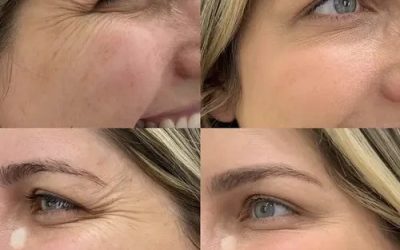 Beauty Boost Med Spa